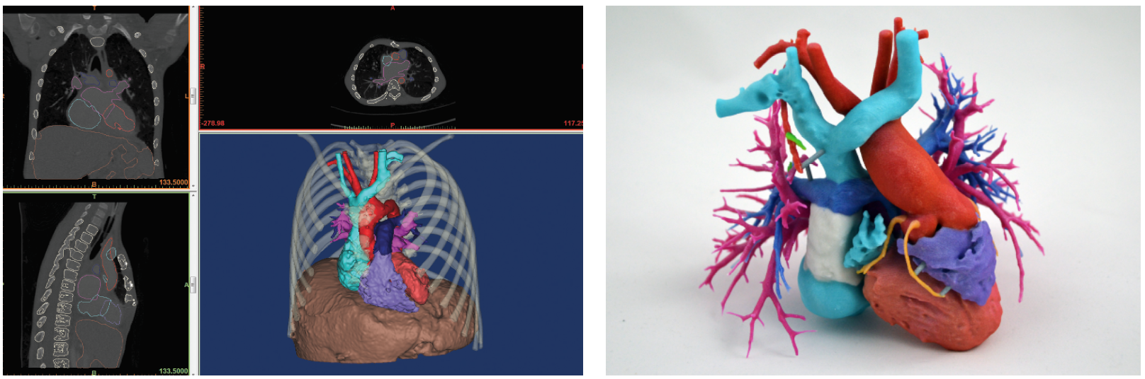 3d Heart 3d Heart